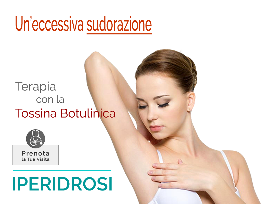 Iperidrosi